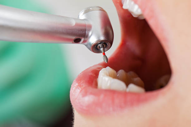 Best Cosmetic Emergency Dentistry in Newington Forest, VA